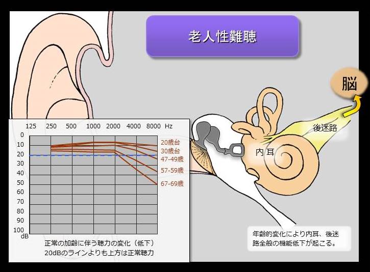 軽度 の 老人 性 難聴 の 特徴 は どれ か