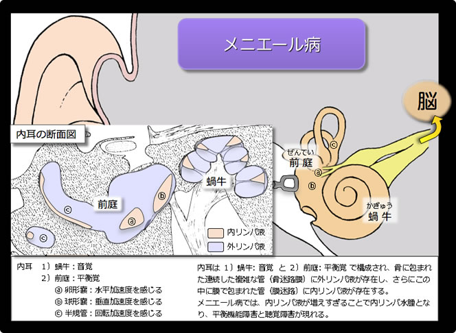 メニエール 病 どのくらい で 治る