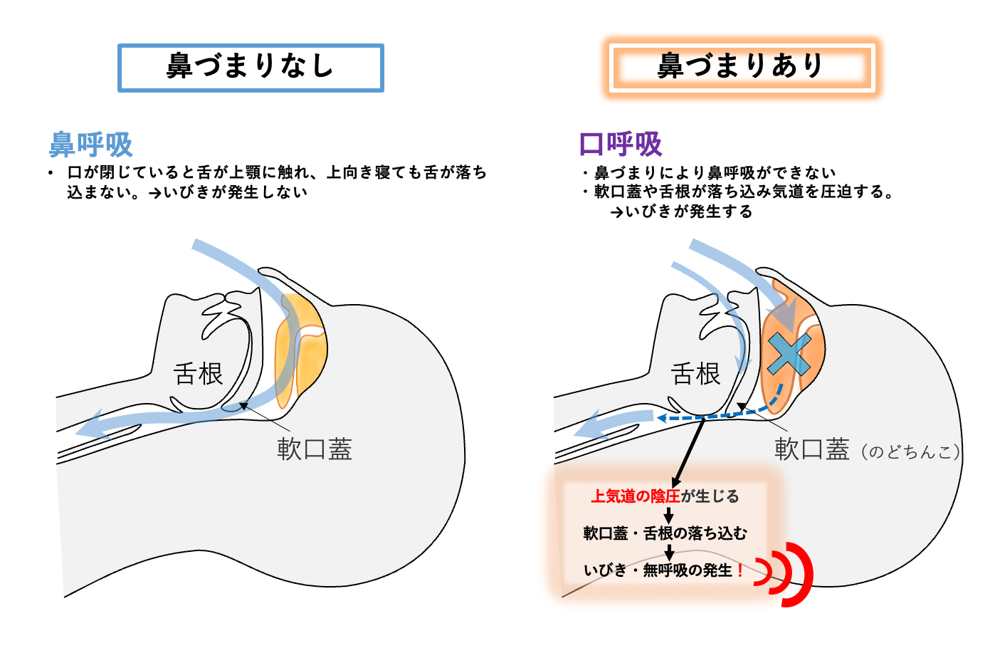 いびき 鼻 の 奥 が 鳴る